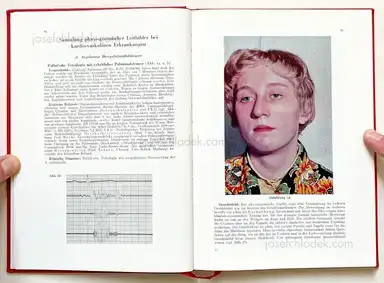 Sample page 19 for book "Schmidt-Voigt, Jörgen – Jörgen Schmidt-Voigt - Das Gesicht des Herzkranken" Sample page 19 for book "Schmidt-Voigt, Jörgen – Jörgen Schmidt-Voigt - Das Gesicht des Herzkranken"