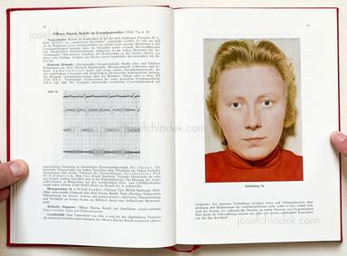 Sample page 2 for book Jörgen Schmidt-Voigt – Das Gesicht des Herzkranken. 