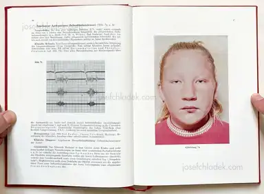 Sample page 17 for book "Schmidt-Voigt, Jörgen – Jörgen Schmidt-Voigt - Das Gesicht des Herzkranken" Sample page 17 for book "Schmidt-Voigt, Jörgen – Jörgen Schmidt-Voigt - Das Gesicht des Herzkranken"