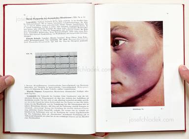 Sample page 4 for book Jörgen Schmidt-Voigt – Das Gesicht des Herzkranken. 
