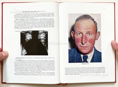 Sample page 5 for book Jörgen Schmidt-Voigt – Das Gesicht des Herzkranken. 
