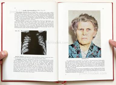 Sample page 14 for book "Schmidt-Voigt, Jörgen – Jörgen Schmidt-Voigt - Das Gesicht des Herzkranken" Sample page 14 for book "Schmidt-Voigt, Jörgen – Jörgen Schmidt-Voigt - Das Gesicht des Herzkranken"