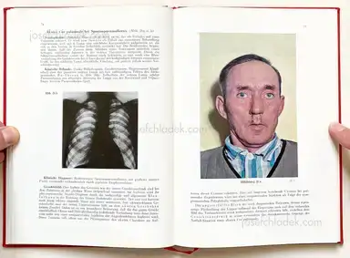 Sample page 13 for book "Schmidt-Voigt, Jörgen – Jörgen Schmidt-Voigt - Das Gesicht des Herzkranken" Sample page 13 for book "Schmidt-Voigt, Jörgen – Jörgen Schmidt-Voigt - Das Gesicht des Herzkranken"