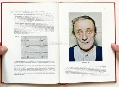 Sample page 11 for book "Schmidt-Voigt, Jörgen – Jörgen Schmidt-Voigt - Das Gesicht des Herzkranken" Sample page 11 for book "Schmidt-Voigt, Jörgen – Jörgen Schmidt-Voigt - Das Gesicht des Herzkranken"