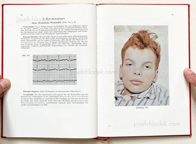 Sample page 10 for book "Schmidt-Voigt, Jörgen – Jörgen Schmidt-Voigt - Das Gesicht des Herzkranken" Sample page 10 for book "Schmidt-Voigt, Jörgen – Jörgen Schmidt-Voigt - Das Gesicht des Herzkranken"