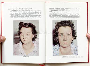 Sample page 9 for book "Schmidt-Voigt, Jörgen – Jörgen Schmidt-Voigt - Das Gesicht des Herzkranken" Sample page 9 for book "Schmidt-Voigt, Jörgen – Jörgen Schmidt-Voigt - Das Gesicht des Herzkranken"