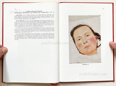 Sample page 14 for book Jörgen Schmidt-Voigt – Das Gesicht des Herzkranken. 