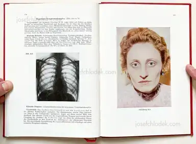 Sample page 3 for book "Schmidt-Voigt, Jörgen – Jörgen Schmidt-Voigt - Das Gesicht des Herzkranken" Sample page 3 for book "Schmidt-Voigt, Jörgen – Jörgen Schmidt-Voigt - Das Gesicht des Herzkranken"