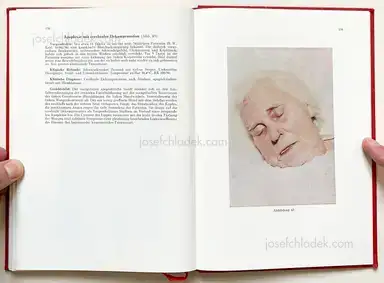 Sample page 2 for book "Schmidt-Voigt, Jörgen – Jörgen Schmidt-Voigt - Das Gesicht des Herzkranken" Sample page 2 for book "Schmidt-Voigt, Jörgen – Jörgen Schmidt-Voigt - Das Gesicht des Herzkranken"