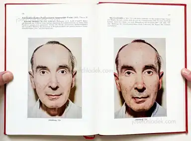 Sample page 1 for book "Schmidt-Voigt, Jörgen – Jörgen Schmidt-Voigt - Das Gesicht des Herzkranken" Sample page 1 for book "Schmidt-Voigt, Jörgen – Jörgen Schmidt-Voigt - Das Gesicht des Herzkranken"