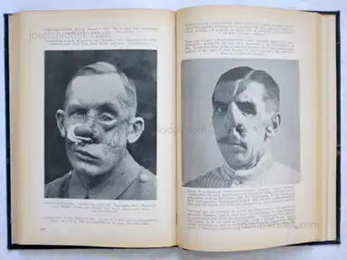 Sample page 2 for book "Friedrich, Ernst – Ernst Friedrich - Krieg dem Kriege - Guerre a la Guerre - War against War - Vojnu Vojne." Sample page 2 for book "Friedrich, Ernst – Ernst Friedrich - Krieg dem Kriege - Guerre a la Guerre - War against War - Vojnu Vojne."