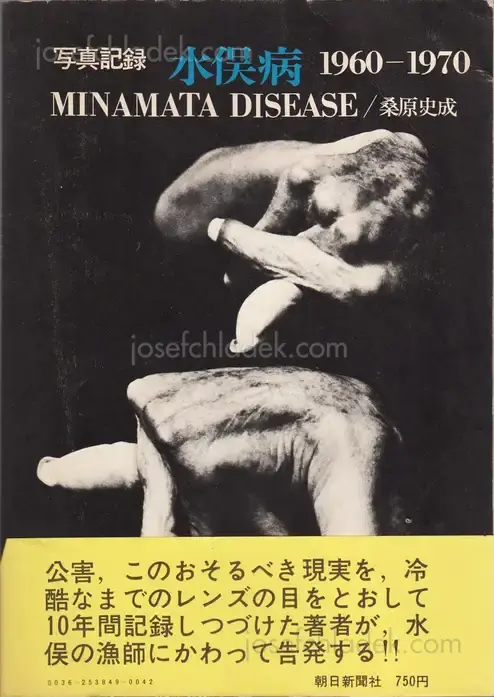 Cover of Shisei Kuwabara - Minamata Disease 1960-1970 (桑原 史成 写真記録 水俣病 1960–1970)