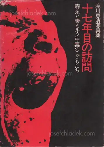 Cover of Yoshikiyo Takigawa - Jū nana nen-me no hōmon; Morinaga hiso miruku chūdoku no kodomo-tachi (十七年目の訪問―森永ヒ素ミルク中毒のこどもたち 滝川恵清写真集)