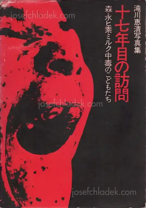 Cover of Yoshikiyo Takigawa - Jū nana nen-me no hōmon; Morinaga hiso miruku chūdoku no kodomo-tachi (十七年目の訪問―森永ヒ素ミルク中毒のこどもたち 滝川恵清写真集)