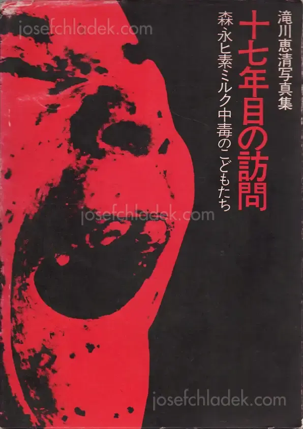 Cover of Yoshikiyo Takigawa - Jū nana nen-me no hōmon; Morinaga hiso miruku chūdoku no kodomo-tachi (十七年目の訪問―森永ヒ素ミルク中毒のこどもたち 滝川恵清写真集)