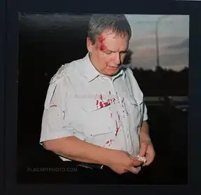 Battered (SIGNED)