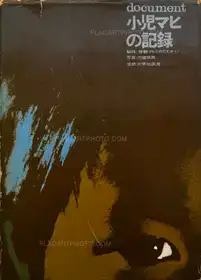 Document : Shonimahi no kiroku / Document : Record of Infantile paralysis